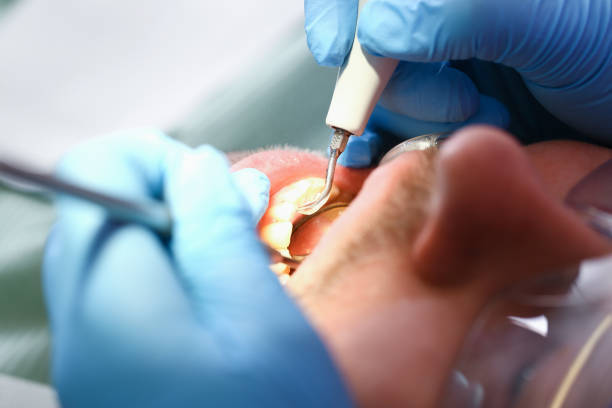 Best Dentist for Dental Trauma  in Palmyra, WI